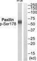 PXN / Paxillin Antibody - Western blot of extracts from HT-29, using Paxillin (Phospho-Ser178) Antibody.
