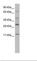 PYCARD / ASC / TMS1 Antibody - Thymus Lysate.  This image was taken for the unconjugated form of this product. Other forms have not been tested.