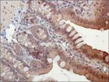 PYCARD / ASC / TMS1 Antibody - Immunohistochemistry: ASC/TMS1 Antibody - IHC of ASC/TMS1 in mouse intestine using DAB with hematoxylin counterstain.  This image was taken for the unconjugated form of this product. Other forms have not been tested.
