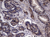 PYDC1 Antibody - IHC of paraffin-embedded Human prostate tissue using anti-PYDC1 mouse monoclonal antibody. (Heat-induced epitope retrieval by 1 mM EDTA in 10mM Tris, pH8.5, 120°C for 3min).