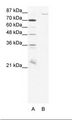 Pyrin / MEFV / MEF Antibody - A: Marker, B: HepG2 Cell Lysate.  This image was taken for the unconjugated form of this product. Other forms have not been tested.