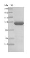 Putative L-asparaginase Protein - (Tris-Glycine gel) Discontinuous SDS-PAGE (reduced) with 5% enrichment gel and 15% separation gel.