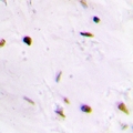 QDPR / DHPR Antibody - Immunohistochemical analysis of QDPR staining in human brain formalin fixed paraffin embedded tissue section. The section was pre-treated using heat mediated antigen retrieval with sodium citrate buffer (pH 6.0). The section was then incubated with the antibody at room temperature and detected using an HRP conjugated compact polymer system. DAB was used as the chromogen. The section was then counterstained with hematoxylin and mounted with DPX.