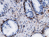 QPRT Antibody - IHC of paraffin-embedded Human prostate tissue using anti-QPRT mouse monoclonal antibody.