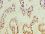 QRSL1 / GatA Antibody - Immunohistochemistry of paraffin-embedded human small intestine tissue at dilution of 1:100