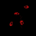 RAB11A Antibody - Immunofluorescent analysis of RAB11A staining in MCF7 cells. Formalin-fixed cells were permeabilized with 0.1% Triton X-100 in TBS for 5-10 minutes and blocked with 3% BSA-PBS for 30 minutes at room temperature. Cells were probed with the primary antibody in 3% BSA-PBS and incubated overnight at 4 deg C in a humidified chamber. Cells were washed with PBST and incubated with a DyLight 594-conjugated secondary antibody (red) in PBS at room temperature in the dark.