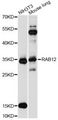 RAB12 Antibody - Western blot analysis of extracts of various cell lines, using RAB12 antibody at 1:3000 dilution. The secondary antibody used was an HRP Goat Anti-Rabbit IgG (H+L) at 1:10000 dilution. Lysates were loaded 25ug per lane and 3% nonfat dry milk in TBST was used for blocking. An ECL Kit was used for detection and the exposure time was 60s.