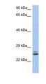 RAB15 Antibody - RAB15 antibody Western blot of THP-1 cell lysate. This image was taken for the unconjugated form of this product. Other forms have not been tested.