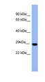 RAB1A Antibody - RAB1A antibody Western blot of Fetal Muscle lysate. This image was taken for the unconjugated form of this product. Other forms have not been tested.