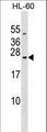 RAB20 Antibody - RAB20 Antibody western blot of HL-60 cell line lysates (35 ug/lane). The RAB20 antibody detected the RAB20 protein (arrow).