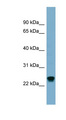 RAB22A / RAB22 Antibody - RAB22A antibody Western blot of MCF7 cell lysate. This image was taken for the unconjugated form of this product. Other forms have not been tested.