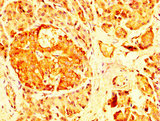 RAB26 Antibody - Immunohistochemistry image at a dilution of 1:200 and staining in paraffin-embedded human pancreas tissue performed on a Leica BondTM system. After dewaxing and hydration, antigen retrieval was mediated by high pressure in a citrate buffer (pH 6.0) . Section was blocked with 10% normal goat serum 30min at RT. Then primary antibody (1% BSA) was incubated at 4 °C overnight. The primary is detected by a biotinylated secondary antibody and visualized using an HRP conjugated SP system.
