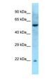 RAB27A / RAB27 Antibody - RAB27A / RAB27 antibody Western Blot of Mouse Pancreas . Antibody dilution: 1 ug/ml.  This image was taken for the unconjugated form of this product. Other forms have not been tested.