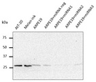 RAB27A / RAB27 Antibody - Western blot. Anti-Rab27 antibody at 1:500 dilution. Rabbit polyclonal to goat IgG (HRP) at 1:10000 dilution.