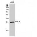 RAB2A / RAB2 Antibody - Western blot of Rab 2A antibody