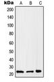RAB2B Antibody - Western blot analysis of RAB2B expression in HepG2 (A); A375 (B); Raw264.7 (C) whole cell lysates.