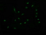 RAB30 Antibody - Immunofluorescent staining of HeLa cells using anti-RAB30 mouse monoclonal antibody.