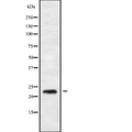 RAB30 Antibody - Western blot analysis of RAB30 using K562 whole cells lysates