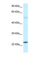 RAB31 Antibody - RAB31 antibody Western blot of Fetal Brain lysate. Antibody concentration 1 ug/ml.  This image was taken for the unconjugated form of this product. Other forms have not been tested.