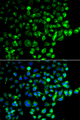 RAB31 Antibody - Immunofluorescence analysis of A549 cells.