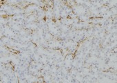 RAB33B Antibody - 1:100 staining mouse kidney tissue by IHC-P. The sample was formaldehyde fixed and a heat mediated antigen retrieval step in citrate buffer was performed. The sample was then blocked and incubated with the antibody for 1.5 hours at 22°C. An HRP conjugated goat anti-rabbit antibody was used as the secondary.