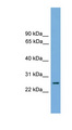 RAB35 Antibody - RAB35 antibody Western blot of Fetal Heart lysate. This image was taken for the unconjugated form of this product. Other forms have not been tested.