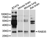 RAB35 Antibody - Western blot analysis of extracts of various cells.