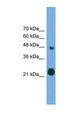 RAB37 Antibody - RAB37 antibody Western blot of Transfected 293T cell lysate. This image was taken for the unconjugated form of this product. Other forms have not been tested.
