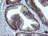 RAB37 Antibody - IHC of paraffin-embedded Human prostate tissue using anti-RAB37 mouse monoclonal antibody.