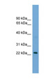 RAB39 / RAB39A Antibody - RAB39 antibody Western blot of HeLa lysate. This image was taken for the unconjugated form of this product. Other forms have not been tested.