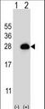 RAB3B Antibody - Western blot of RAB3B (arrow) using rabbit polyclonal RAB3B Antibody. 293 cell lysates (2 ug/lane) either nontransfected (Lane 1) or transiently transfected (Lane 2) with the RAB3B gene.