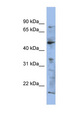 RAB3IP / RABIN3 Antibody - RAB3IP antibody Western blot of NCI-H226 cell lysate. This image was taken for the unconjugated form of this product. Other forms have not been tested.