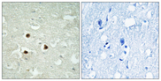 RAB3IP / RABIN3 Antibody - Immunohistochemistry analysis of paraffin-embedded human brain tissue, using RAB3IP Antibody. The picture on the right is blocked with the synthesized peptide.