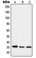 RAB40B Antibody - Western blot analysis of RAB40B expression in HeLa (A); mouse lung (B); rat heart (C) whole cell lysates.