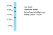 RAB42 Antibody -  This image was taken for the unconjugated form of this product. Other forms have not been tested.