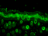 RAB5 Antibody - Rab5, mouse back skin.  This image was taken for the unconjugated form of this product. Other forms have not been tested.