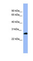 RAB5A / RAB5 Antibody - RAB5A / RAB5 antibody Western blot of Fetal Muscle lysate. This image was taken for the unconjugated form of this product. Other forms have not been tested.