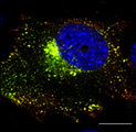 RAB5A / RAB5 Antibody - Immunofluorescence. Anti-Rab5a antibody in transduced Hepa1-6 cells with Ad GFP-Rab5a at 1:50 dilution. Cells were fixed with 4% of PFA.