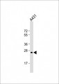 RAB5B Antibody - Anti-RAB5B Antibody at 1:2000 dilution + A431 whole cell lysate Lysates/proteins at 20 ug per lane. Secondary Goat Anti-mouse IgG, (H+L), Peroxidase conjugated at 1:10000 dilution. Predicted band size: 24 kDa. Blocking/Dilution buffer: 5% NFDM/TBST.