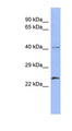 RAB5B Antibody - RAB5B antibody Western blot of Placenta lysate. This image was taken for the unconjugated form of this product. Other forms have not been tested.