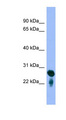 RAB5C Antibody - RAB5C antibody Western blot of Fetal Brain lysate. This image was taken for the unconjugated form of this product. Other forms have not been tested.