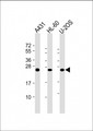 RAB5C Antibody - All lanes: Anti-RAB5C Antibody at 1:2000 dilution. Lane 1: A431 whole cell lysate. Lane 2: HL-60 whole cell lysate. Lane 3: U-2OS whole cell lysate Lysates/proteins at 20 ug per lane. Secondary Goat Anti-mouse IgG, (H+L), Peroxidase conjugated at 1:10000 dilution. Predicted band size: 23 kDa. Blocking/Dilution buffer: 5% NFDM/TBST.