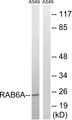 RAB6A / RAB6 Antibody - Western blot analysis of lysates from A549 cells, using RAB6A Antibody. The lane on the right is blocked with the synthesized peptide.