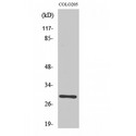 RAB6C Antibody - Western blot of Rab 6C antibody