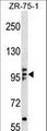 RAB6KIFL / KIF20A Antibody - KIF20A Antibody western blot of ZR-75-1 cell line lysates (35 ug/lane). The KIF20A antibody detected the KIF20A protein (arrow).