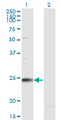 RAB7B Antibody - Western blot of RAB7B expression in transfected 293T cell line by RAB7B monoclonal antibody (M02), clone 1C3.