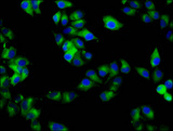 RAB7B Antibody - Immunofluorescence staining of Hela cells diluted at 1:133, counter-stained with DAPI. The cells were fixed in 4% formaldehyde, permeabilized using 0.2% Triton X-100 and blocked in 10% normal Goat Serum. The cells were then incubated with the antibody overnight at 4°C.The Secondary antibody was Alexa Fluor 488-congugated AffiniPure Goat Anti-Rabbit IgG (H+L).