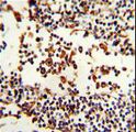 Antibody - Formalin-fixed and paraffin-embedded human Lymph reacted with IGHA1 Antibody , which was peroxidase-conjugated to the secondary antibody, followed by DAB staining. This data demonstrates the use of this antibody for immunohistochemistry; clinical relevance has not been evaluated.