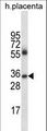 Antibody - IGHG4 Antibody western blot of human placenta tissue lysates (35 ug/lane). The IGHG4 antibody detected the IGHG4 protein (arrow).