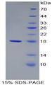 TTR / Transthyretin Protein - Recombinant Transthyretin By SDS-PAGE